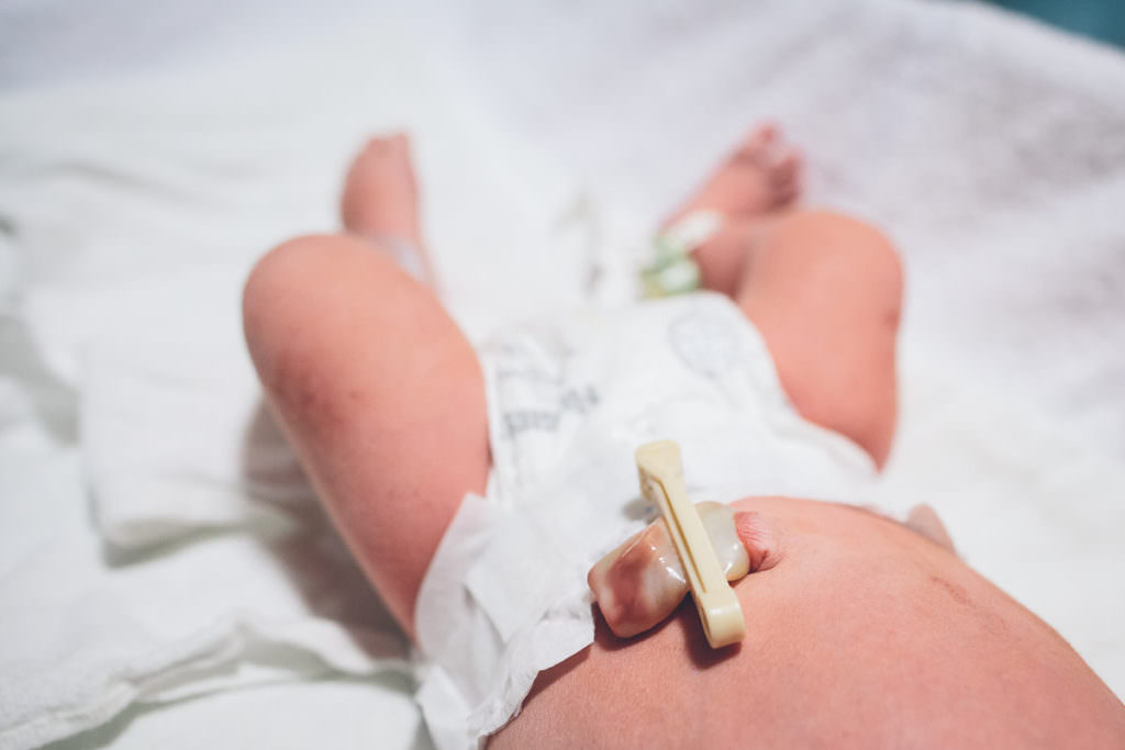 close up pictures of where newborn umbilical chord was cut