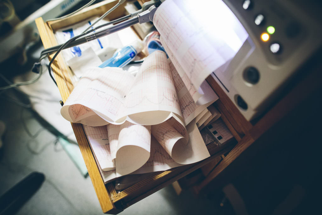 heart rate and contraction print out on paper at hospital