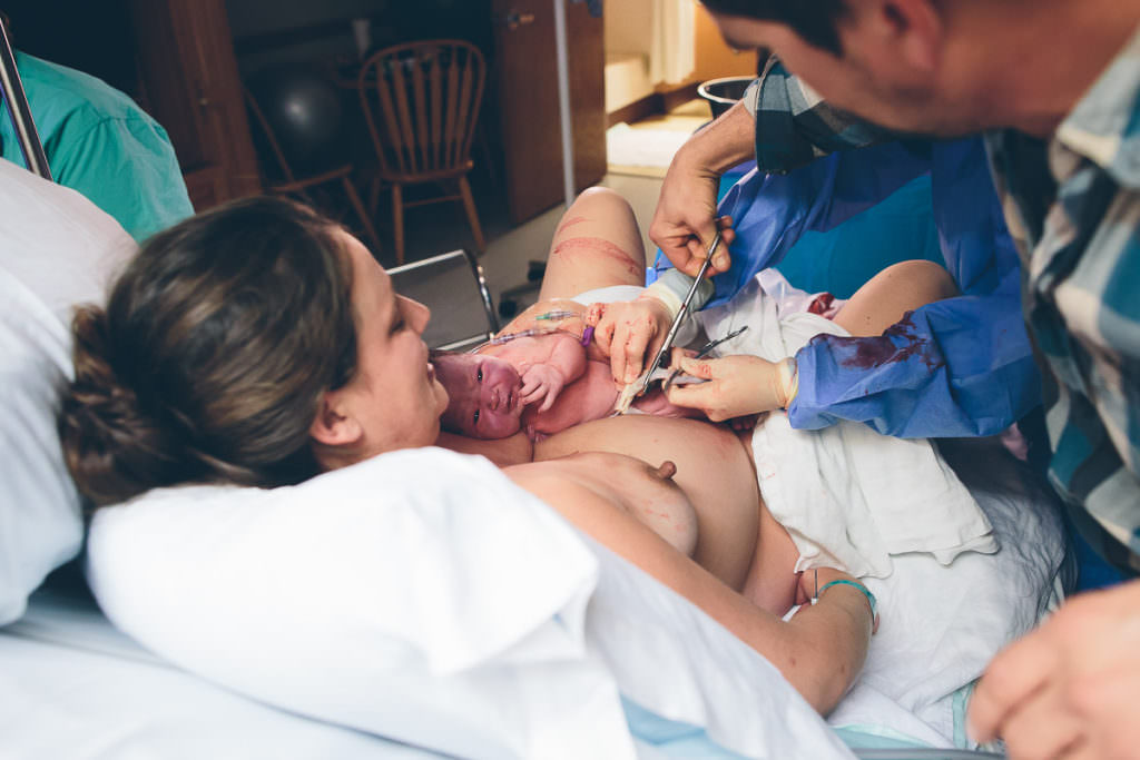 dad cuts umbilical chord after hospital birth in troy new york