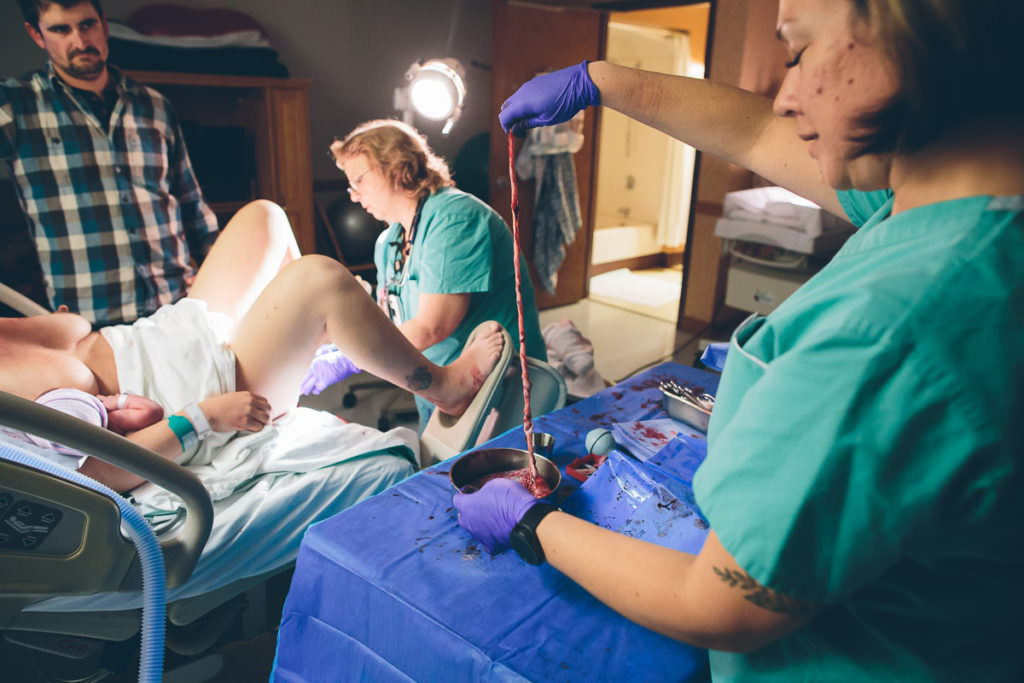 midwife shows length of umbilical chord while checking placenta
